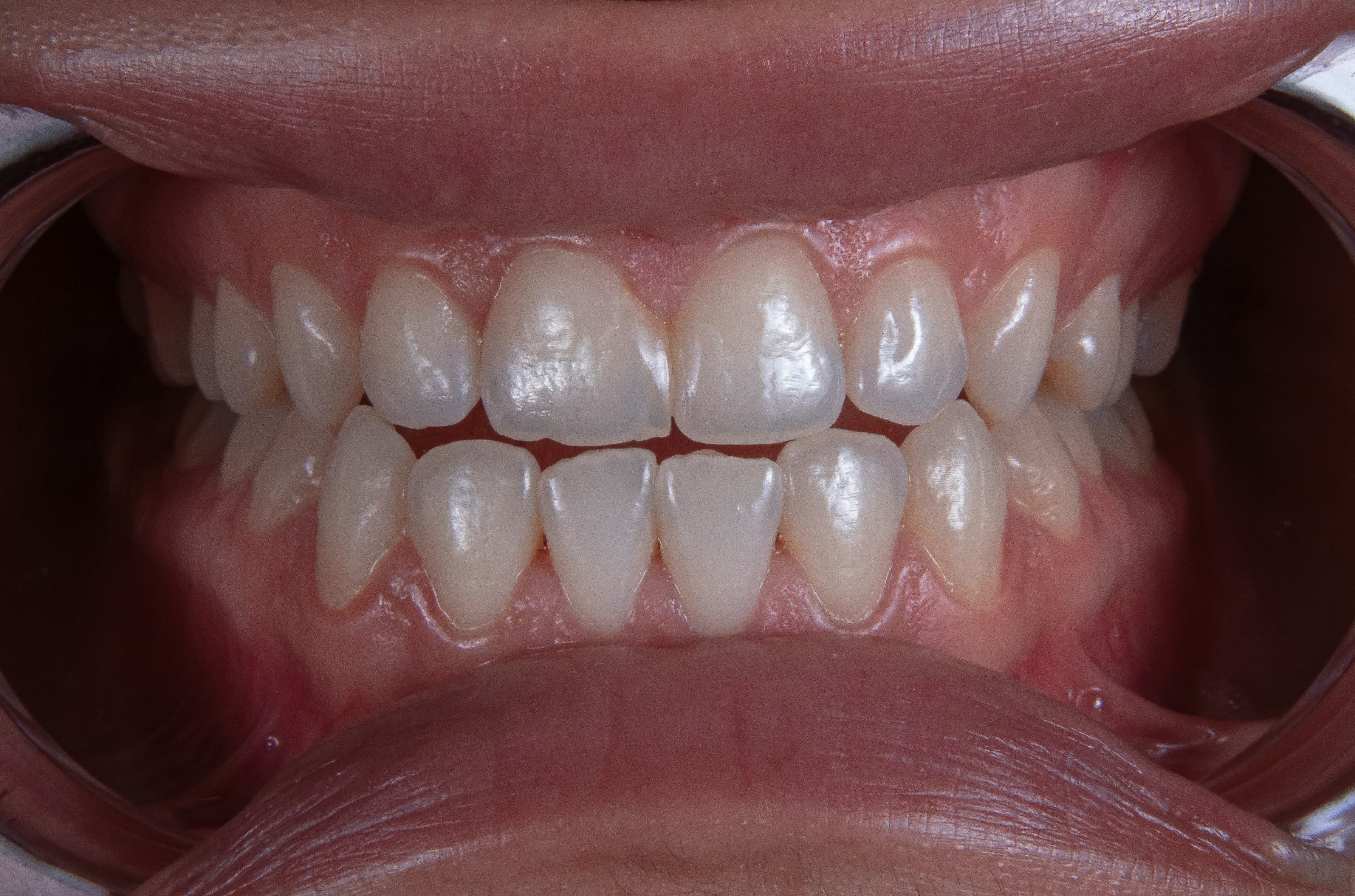 Estética Dental